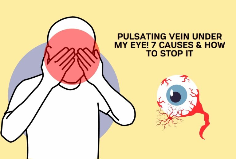Pulsating Vein Under My Eye! 7 Causes & How To Stop It (Full Guide)