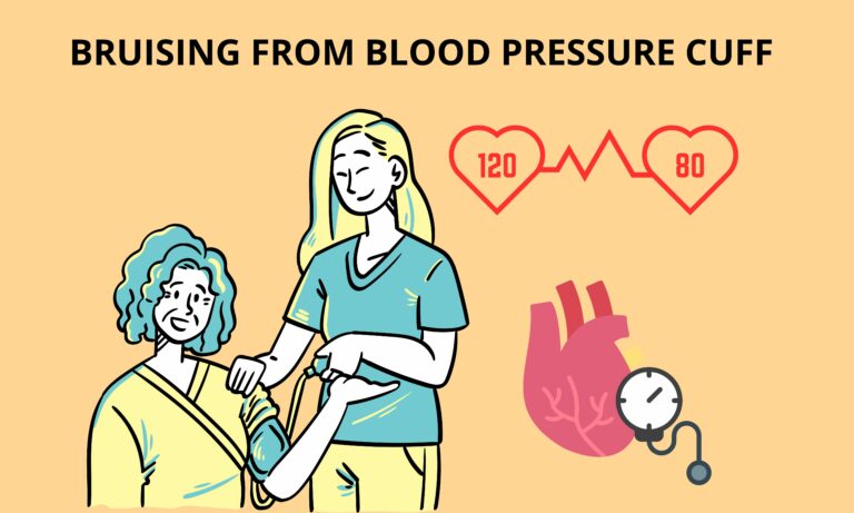 Bruising From Blood Pressure Cuff (What Causes It & What To Watch Out For)[Full Guide]