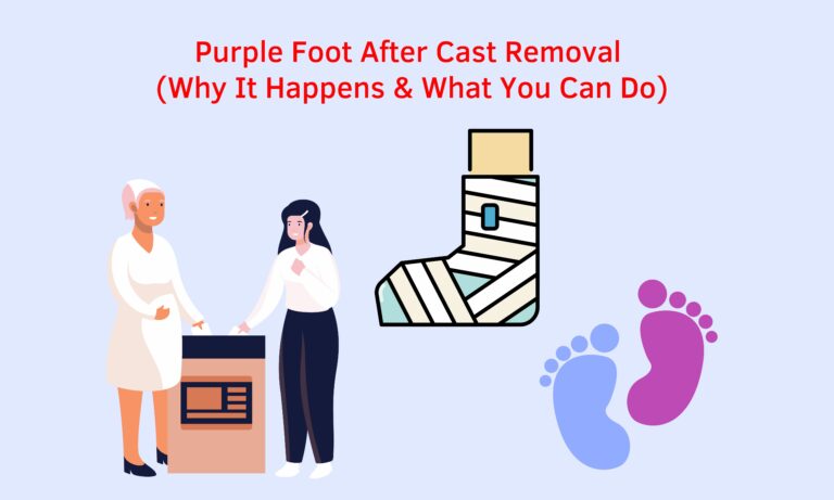 Purple Foot After Cast Removal (Why It Happens & What You Can Do) (All You need to know)