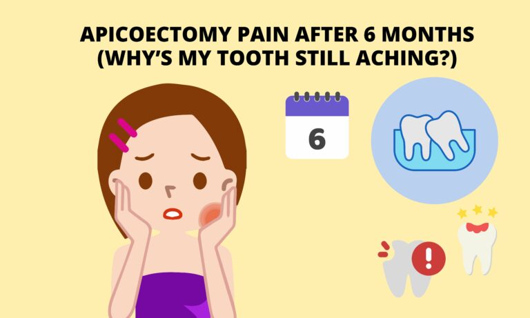Apicoectomy Pain After 6 Months (Why’s My Tooth Still Aching?(Quick Guide)