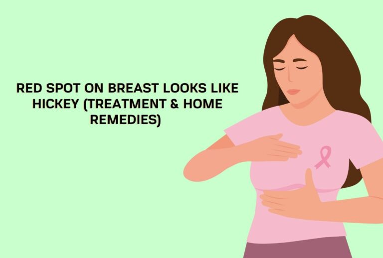 Red Spot On Breast Looks Like Hickey (Treatment & Home Remedies) (Learn More)