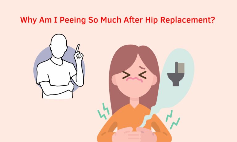Why Am I Peeing So Much After Hip Replacement?(Learn More)