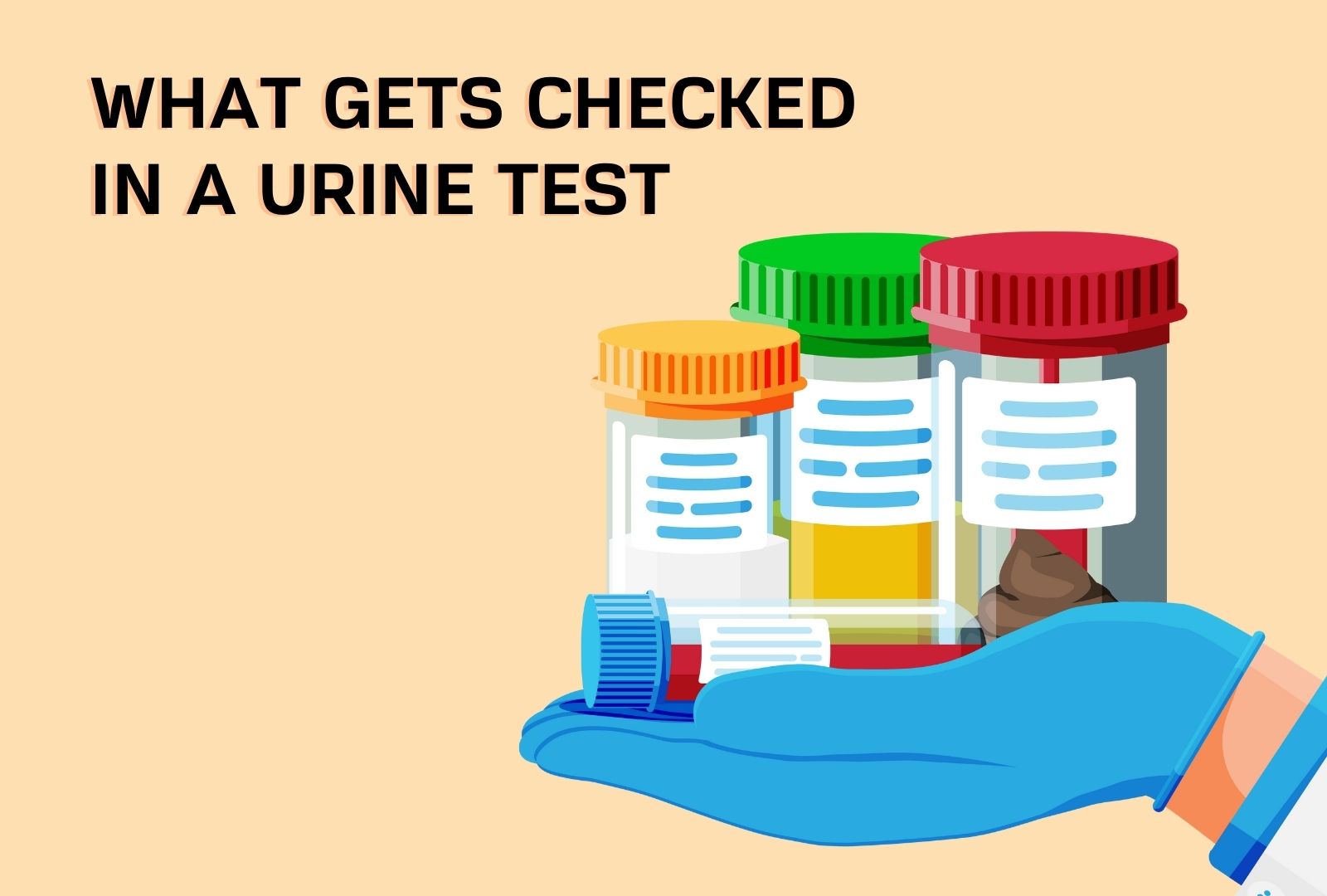 what-does-occ-in-urine-test-mean-and-what-all-gets-checked-in-a-urine