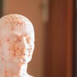 Acupuncture